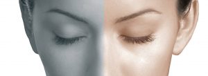 mesoestetic